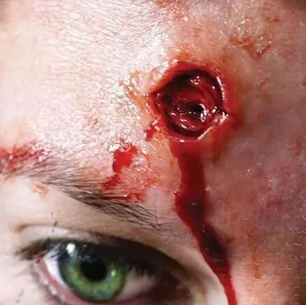 Cicatrice Fx Transferts 3d Impacts De Balle 1 Cicatrice Fx Transferts 3d Impacts De Balle