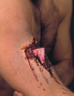 Cicatrice Latex Fracture Ouverte