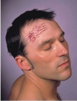 Cicatrice Latex Éraflures