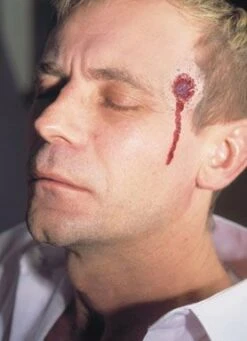 Cicatrice Latex Impact De Balle