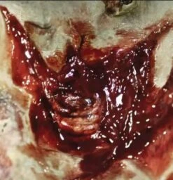 Cicatrice Fx Transferts 3d Gorge Arrachée Zombie