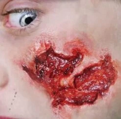 Cicatrice Peau Arrachée Fx Transferts 3d