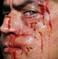 Cicatrice Fx Transferts 3d Blessures