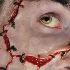 Cicatrice Fx Transferts 3d Points De Suture