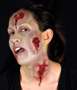 Cicatrices Plaies Suintantes