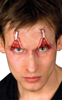 Cicatrice Paupière Retournée